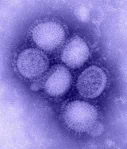 Imagem de microscópio electrónico do vírus da gripe A (H1N1) rearranjado